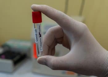 NICD reveals racial divide in Covid-19 deaths