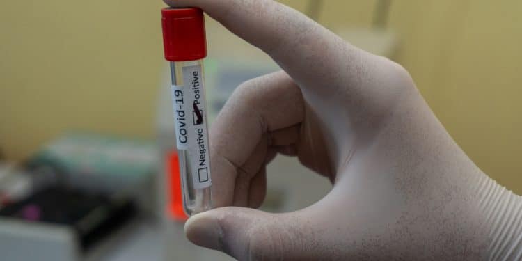 NICD reveals racial divide in Covid-19 deaths