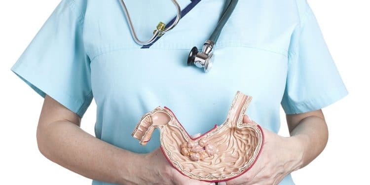 Raising awareness about ‘lethal’ oesophageal cancer in Africa