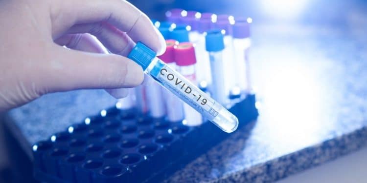 A KZN learner to compete at a global science fair