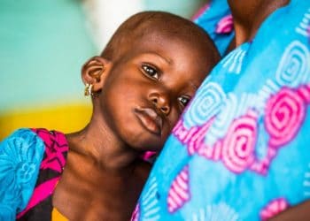 Youngster finds a new way to diagnose malnutrition