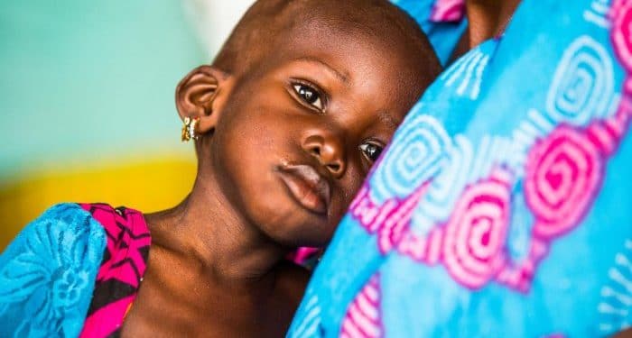 Youngster finds a new way to diagnose malnutrition