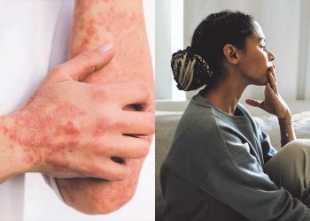 Alternative treatment can’t work when the body is at war with itself