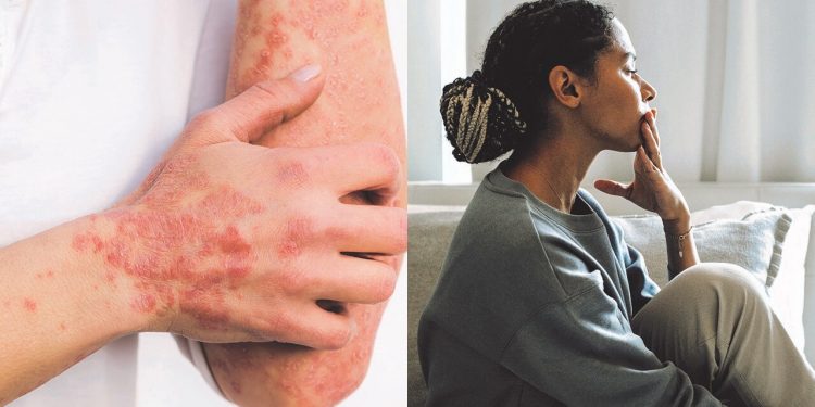 Alternative treatment can’t work when the body is at war with itself