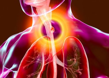 Maize is the main contributory factor to Oesophageal cancer, says a research study