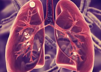 <strong>Eastern Cape is the flashpoint of the high TB infections rate in the country</strong> 21 Eastern Cape is the flashpoint of the high TB infections rate in the country