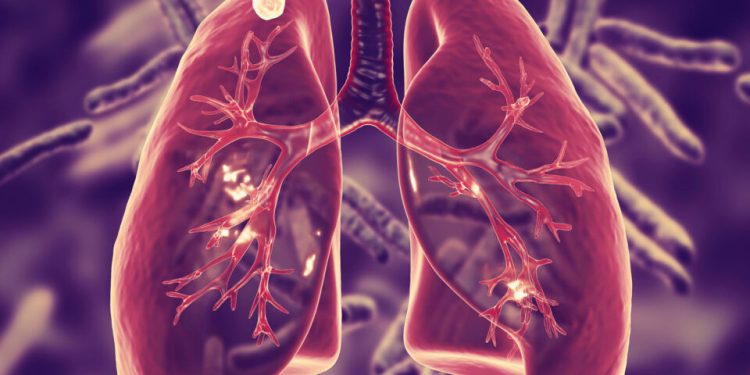 Eastern Cape is the flashpoint of the high TB infections rate in the country