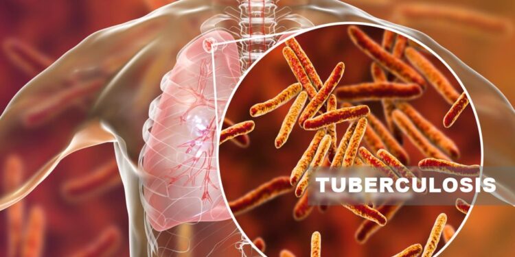 bedaquiline used for treatment of tuberculosis