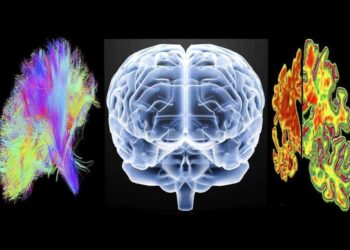 Terminal diseases like Alzheimers Disease