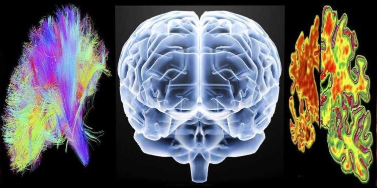 Terminal diseases like Alzheimers Disease